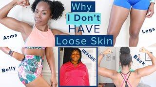 Why I Don't Have LOOSE SKIN After 100 Pound Weight Loss WITHOUT Surgery | TMI Skincare & Nutrition