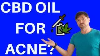 CBD OIL FOR ACNE AND SKIN | Does It REALLY Work? | Chris Gibson