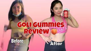 GOLI APPLE CIDER VINEGAR GUMMIES REVIEW| WEIGHTLOSS JOURNEY 2021 | Alyssa Calderon